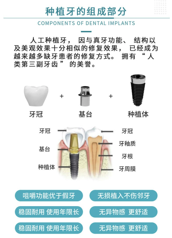 限北京牙管家北京瑞士iti种植牙