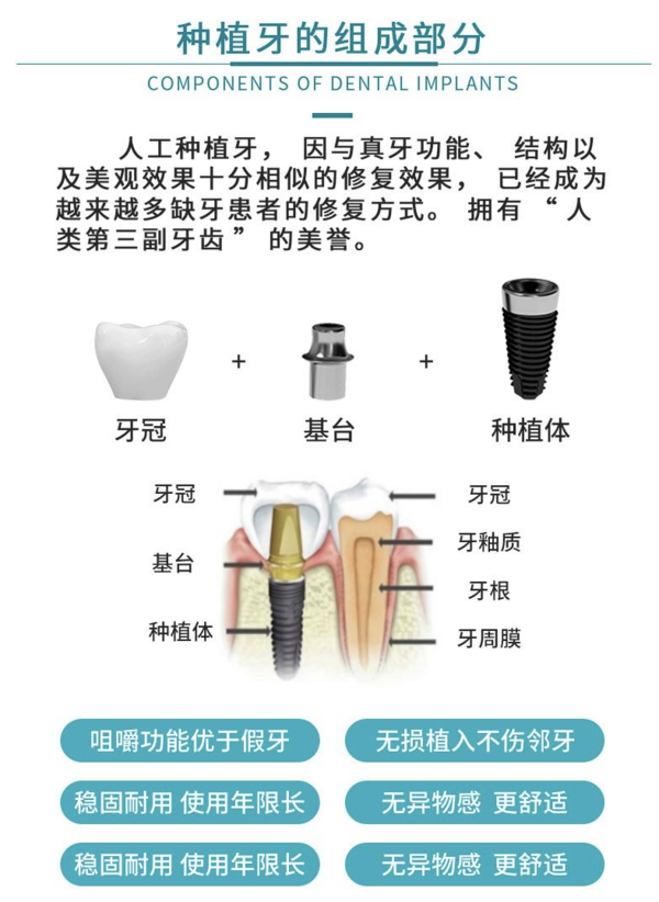 牙管家 韩国Dentium登腾牙齿种植套餐 