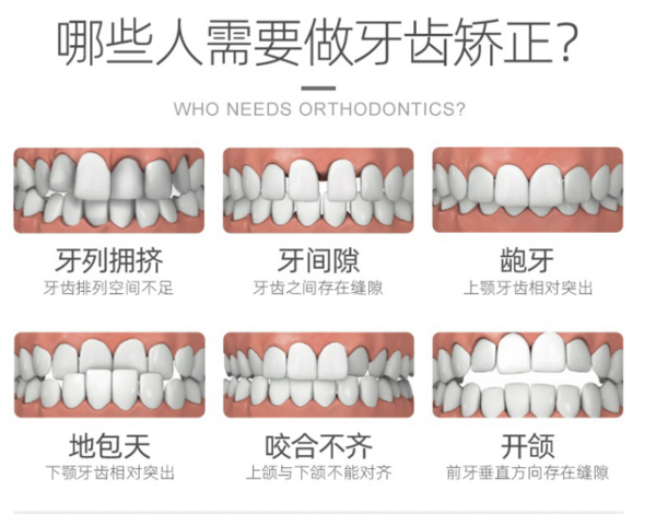 奢己医美 隐形牙齿正畸检查套餐