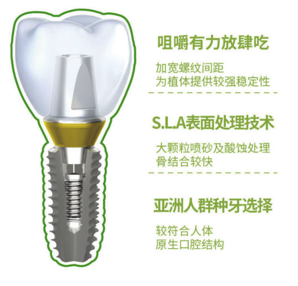 英博口腔 韩国进口种植牙套餐