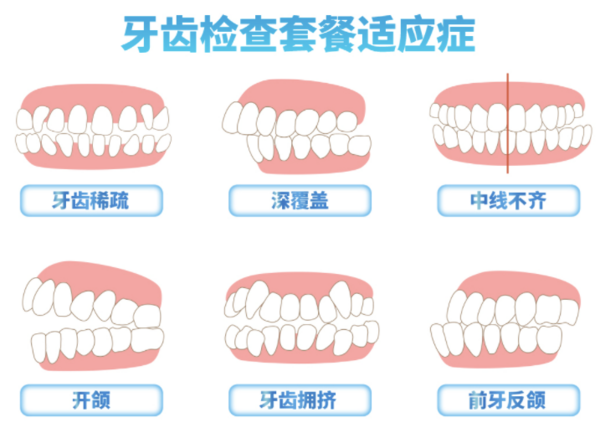 EnjoyDental 欢乐口腔 正畸检查套餐