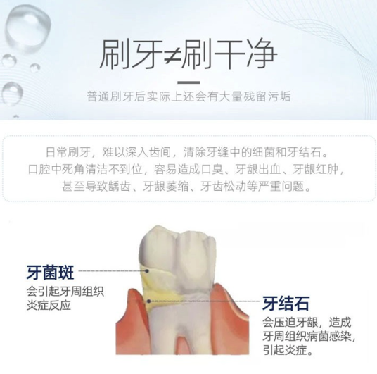 美奥口腔 超声波洗牙卡套餐 （工作日）