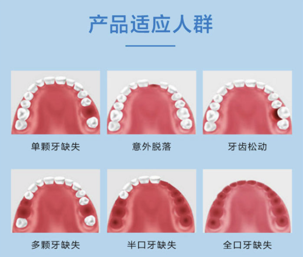 韩国登腾牙套图片