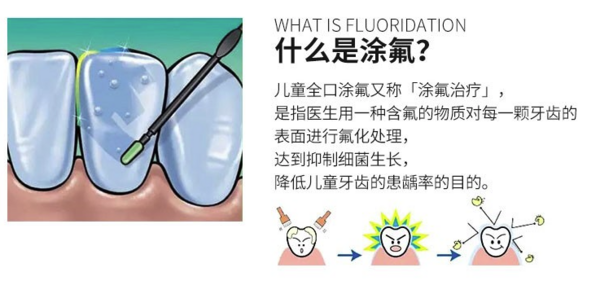 牙博士 儿童全口涂氟防龋套餐 到店核销