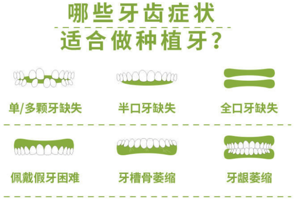 英博口腔 韩国进口种植牙套餐