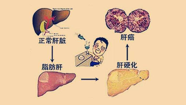 好药保·护肝保障计划 300万保额 赠送肝癌早筛+全年用药