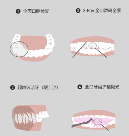 齿研社 VIP会员成人版 洁牙 全国通用