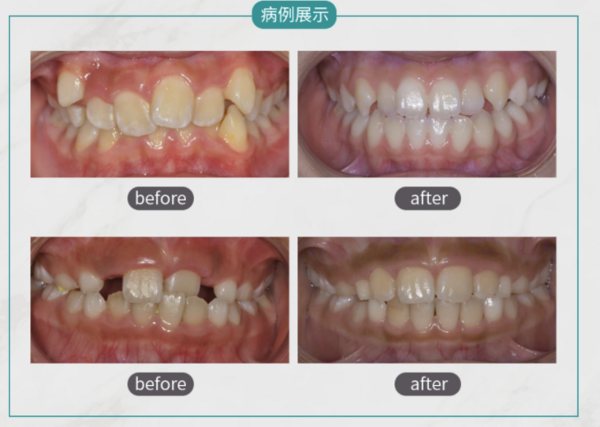 SDM DENTAL 固瑞齿科 颜面管理方案