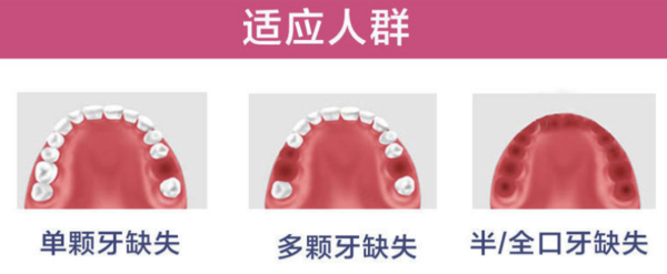 彩虹医生 全口半口固定种植牙