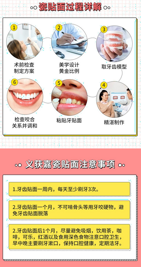 限地区：牙管家 牙齿超薄瓷贴面4颗