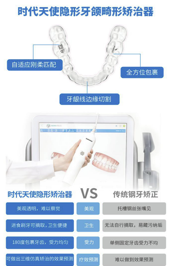 EnjoyDental 欢乐口腔 时代天使矫正套餐