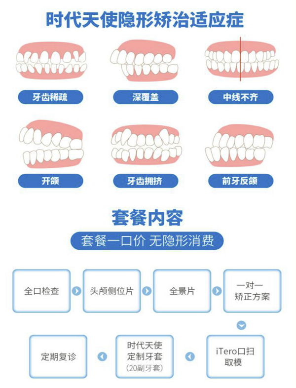 EnjoyDental 欢乐口腔 时代天使矫正套餐