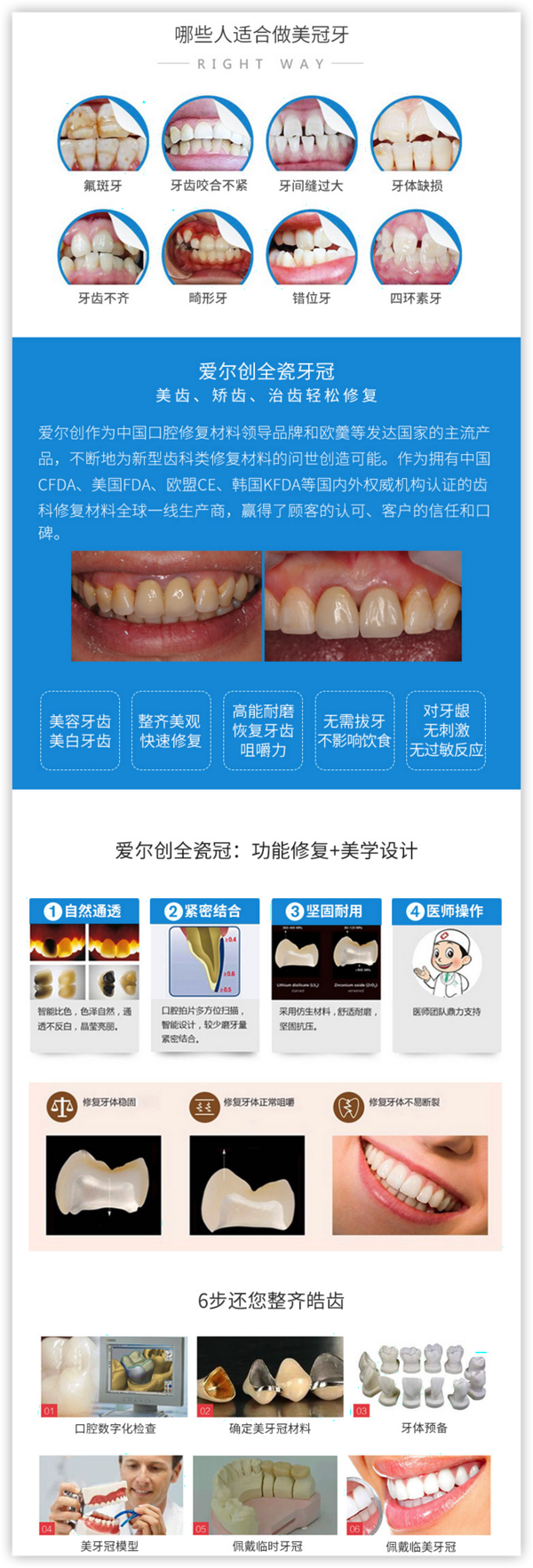 爱尔创 全瓷牙冠