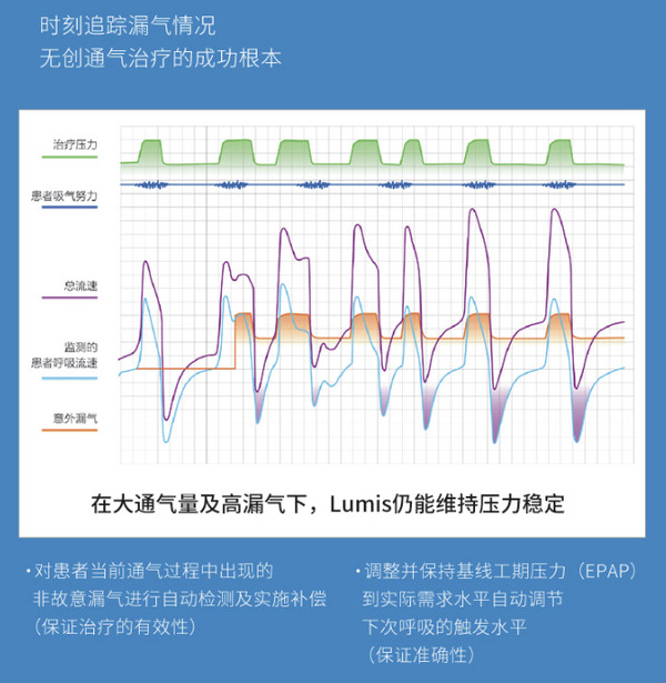 ResMed 瑞思迈 S10 Lumis 双水平无创呼吸机