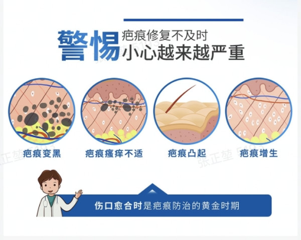 Dermatix 倍舒痕硅酮凝胶 15g