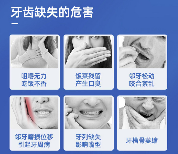 美奥口腔 诺贝尔PMC种植体+基台+全瓷牙冠