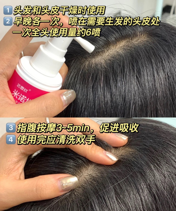 脱发救星:逆袭发量王者就靠它啦！