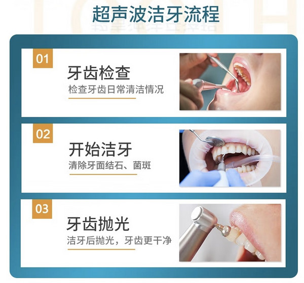 中家医口腔 超声波洁牙