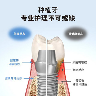 钛舒美 种植牙专用护理牙膏 无氟 种植牙专业术后修复 1支