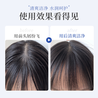 倍膳健 二硫化硒洗发水去屑止痒轻盈控油清爽蓬松柔顺秀发男女通用洗头膏