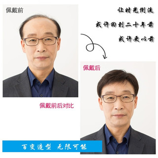 佰丝堂假发男短发真发全真人发丝寸发中年男士头顶补发片块地中海遮白发  自然款【全真发-仿肤递针】18*20