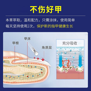 修正灰指甲护理液套装 增厚发黄变空专用液 不包扎不修甲灰甲净