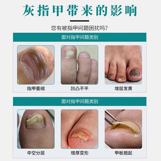 白云山灰指甲专用型液体敷料灰指甲嵌甲指趾甲部位不适症状护理