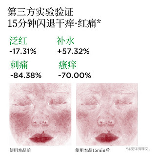 摇滚动物园摇滚动物园牛油果神经酰胺绿洲面膜片状舒缓修护敏肌补水保湿 摇滚动物园面膜25ml*5片