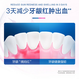 欧乐B（Oral-B）牙膏专护小白管对抗牙龈红肿出血成人清洁牙齿清新口气排浊泡泡 (早)清新90g+对抗红肿出血90g