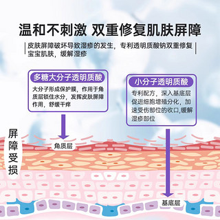 怡成小紫管宝宝湿疹婴儿湿疹霜痒疹口水疹凝胶湿疹膏婴幼儿专用