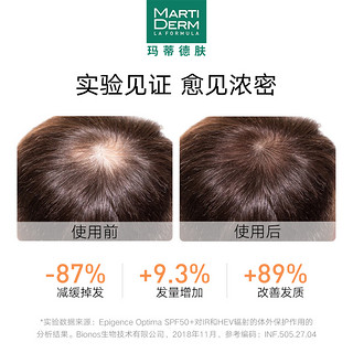 MartiDerm玛蒂德肤改善脱落发安瓶滋养头皮3ml*14支效期至24年3月