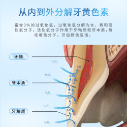 奥普斯布斯特 奥普斯美白牙齿托盘美国原装进口炫白牙贴洁白牙托
