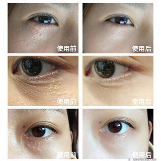 同仁堂 眼霜黑眼圈淡化眼袋细纹脂肪粒鱼尾纹男女20g/支