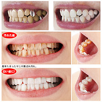 White feather 日本去渍牙刷笔去牙渍黄牙去牙垢去烟渍牙齿亮白笔口腔清洁工具