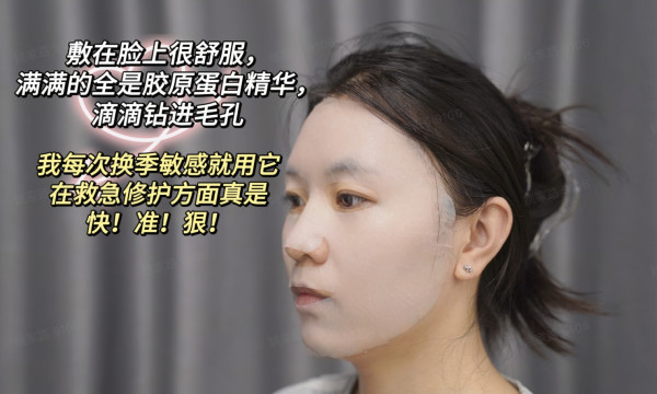 肤可新重组人源化胶原蛋白医用敷料,敏感肌or痘肌,囤货好机会!