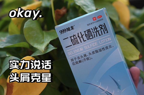 头屑头油严重,大量脱发,用999旭发二硫化硒