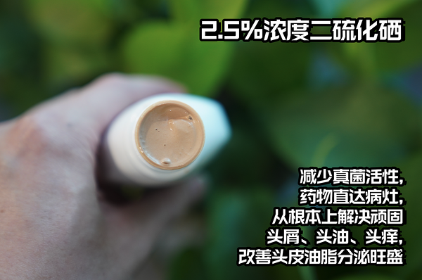 头屑头油严重,大量脱发,用999旭发二硫化硒