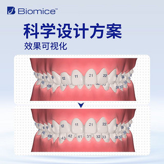 AIDITE 爱迪特 Biomice牙齿矫正器