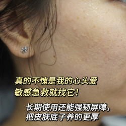 单片价格仅为8.9元，重组人源化胶原蛋白医用敷料