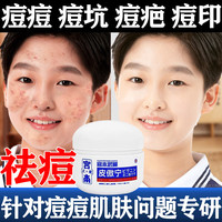 宫本武藏 祛痘膏去痘痘面霜 10g