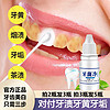 法纳普（FRNP）洗牙液洗牙齿污垢牙渍美白快速黄牙洁牙白牙剂水牙菌斑祛除 牙斑净