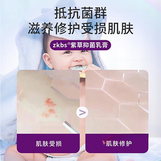 健医师紫草乳膏 适用于辅助理疗婴儿宝宝儿童蚊虫叮咬瘙痒痱子皮肤瘙痒湿红屁屁疹等不适症状男女适用 2盒装