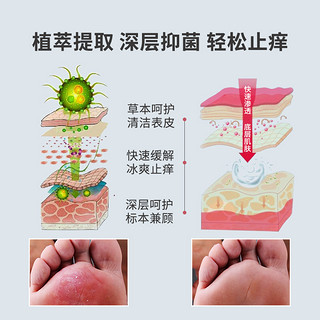 纯春堂云南本草 脚气喷剂脱皮脚臭脚汗水泡型脚痒膏克星喷雾抑菌膏套装