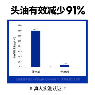 尊蓝免洗干发喷雾180ml 控油去油头发蓬松高颅顶造型去异味蓬蓬粉 【免洗控油】干发喷雾