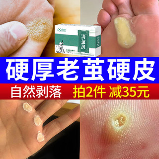  森卓 抑菌 脚茧软化膏剂  1盒装