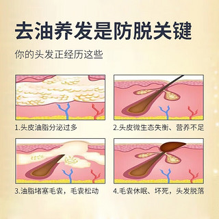 同仁堂防脱育发洗发水生姜密头发增溢脂性脱发控油草本长发老姜王固发 防脱育发洗发水 508ml 1瓶