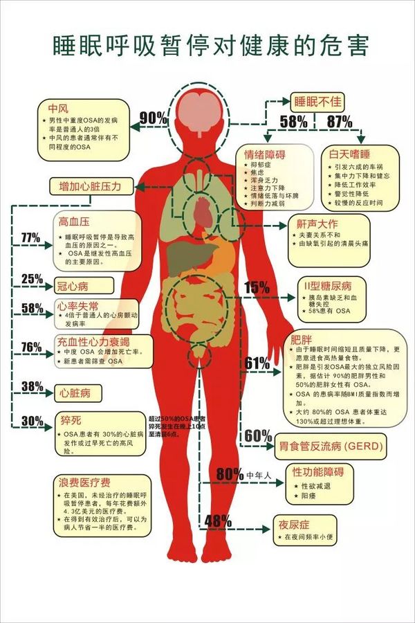 PLUS会员：yuwell 鱼跃 睡觉用了它，精神状态好多了！双水平全自动无创呼吸机YH-720ST