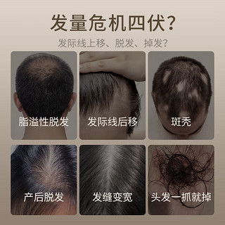 儒意（RUYI）育发液100ml防脱发育发增密头发滋养毛囊发际线头皮营养男女士