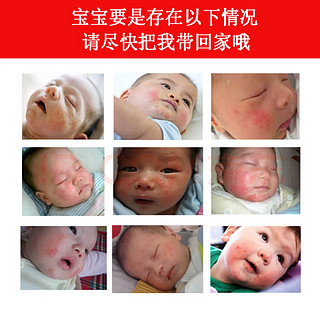 【药房直售】婴儿宝湿疹膏可搭口水疹膏新生婴幼儿抑菌止瘙痒膏婴儿宝宝特护膏护肤霜一起使用无激素 3盒实惠装【更多选择】