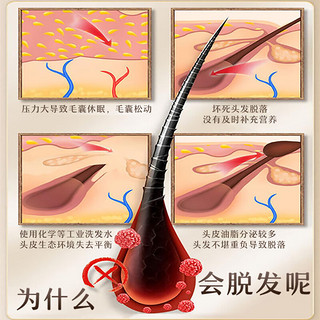 乐家老铺南京同仁堂防脱育发洗发水控油生姜何首乌严重脱发洗发露508g 防脱洗发水✅发量暴涨